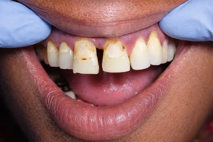 Before treatment