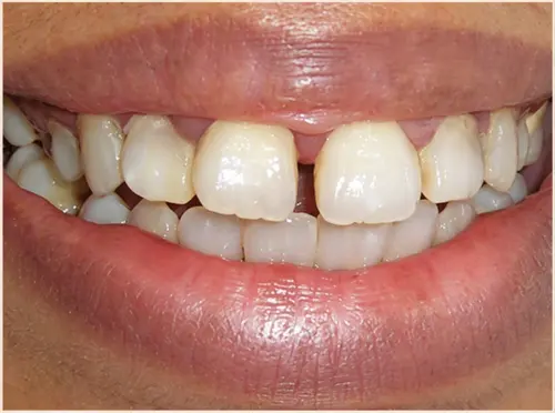 Before treatment