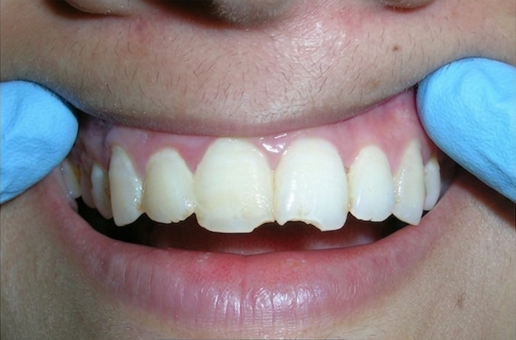 Before treatment
