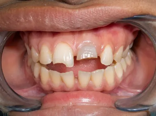 Before treatment