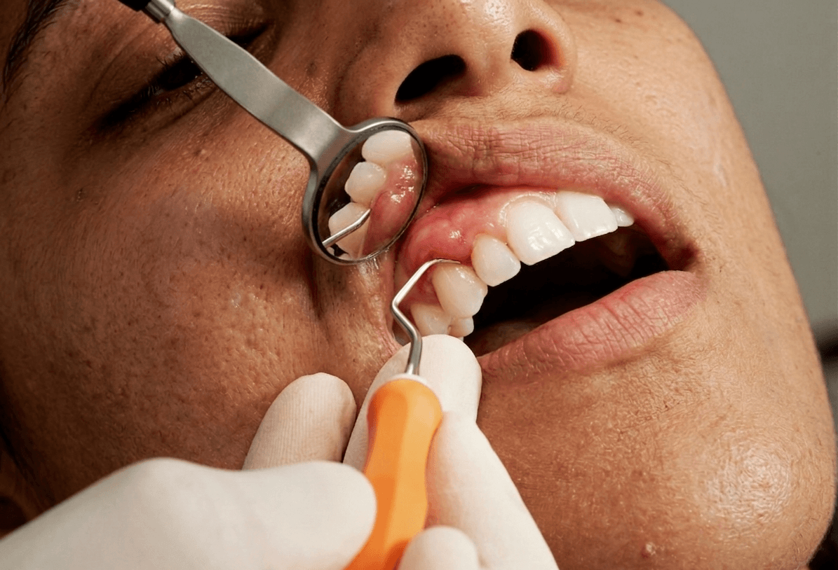 Dentist examining gums