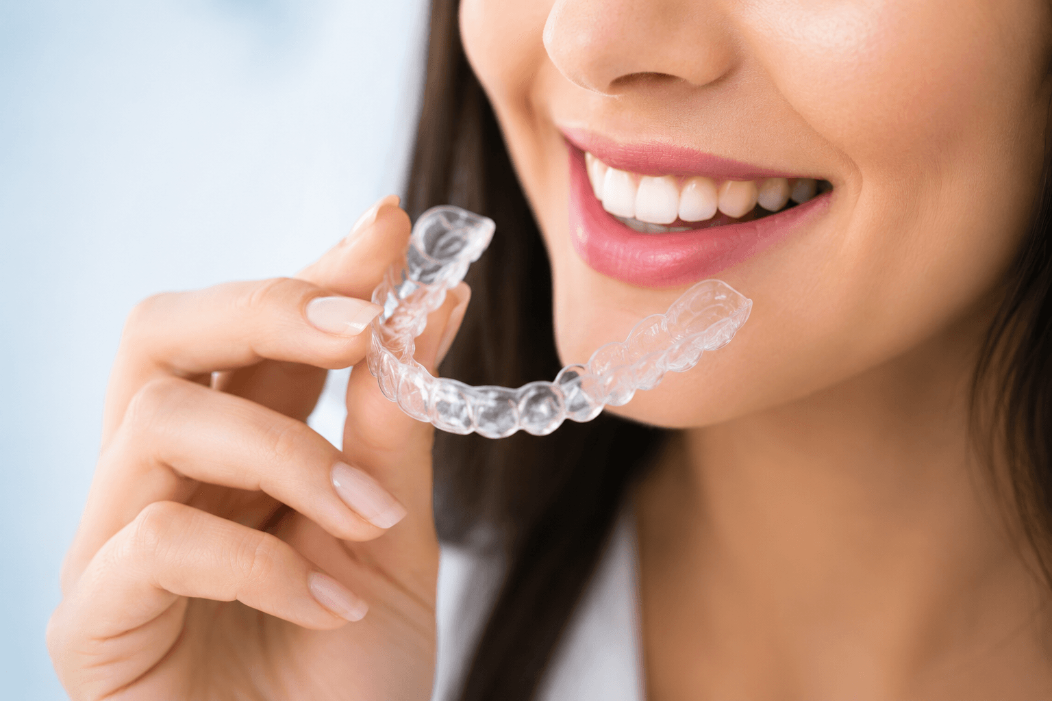 Clear aligner treatment